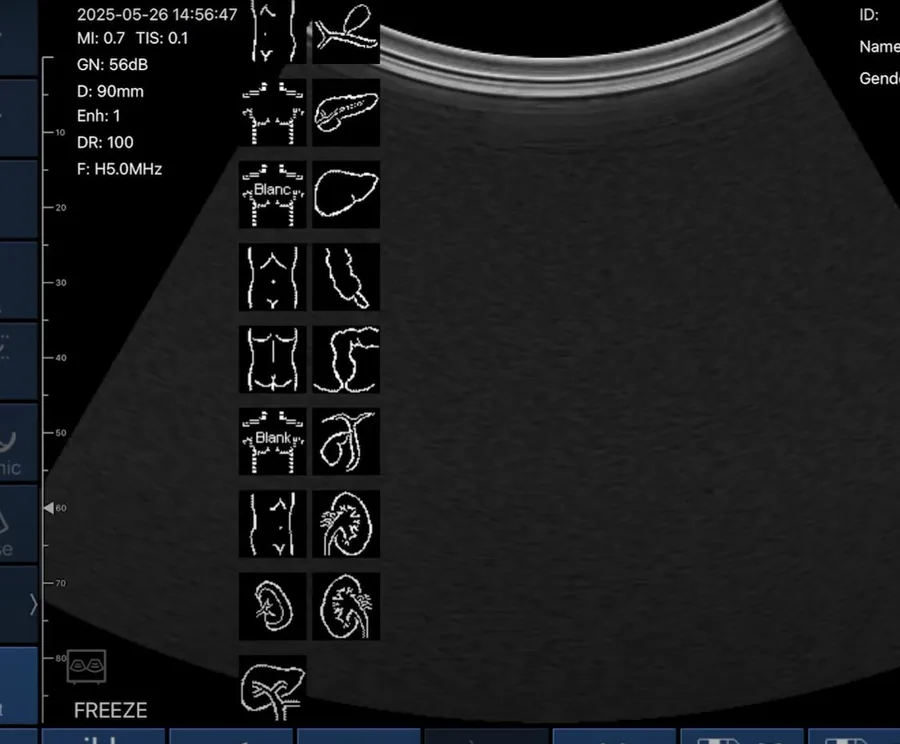 Bodymarks in der ATLAS-App