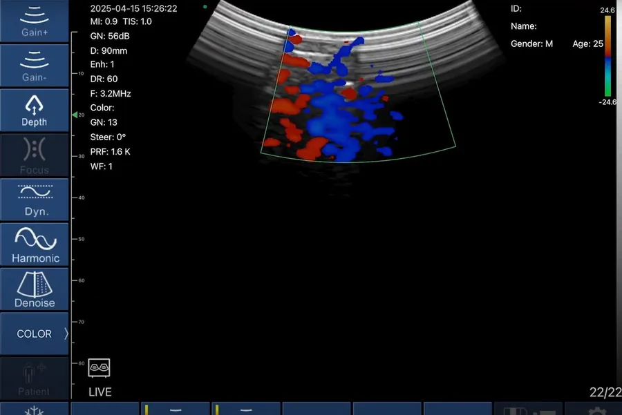 Farbdoppler in der ATLAS-App
